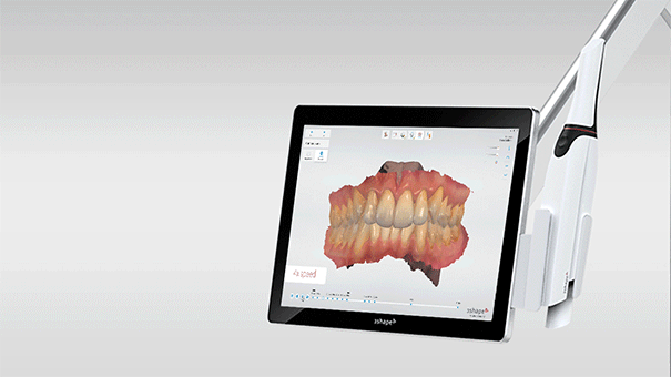 Интраоральный 3D-сканер 3Shape TRIOS 4 WIRELESS 