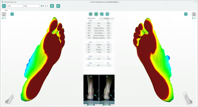 Ортопедический 3D-сканер USOL-DUO