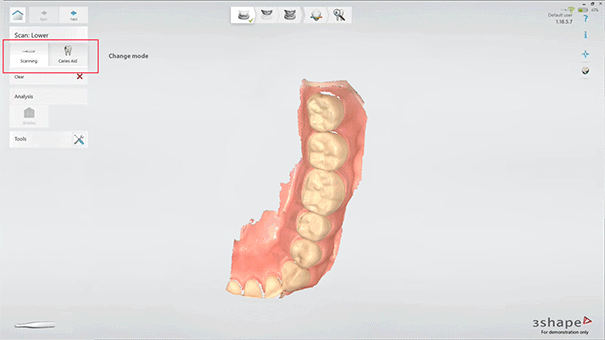 Интраоральный 3D-сканер 3Shape TRIOS 4 WIRELESS 