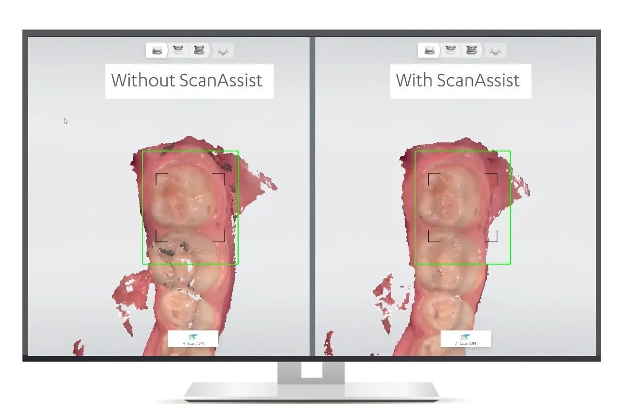 Интраоральный 3D-сканер 3Shape TRIOS 5