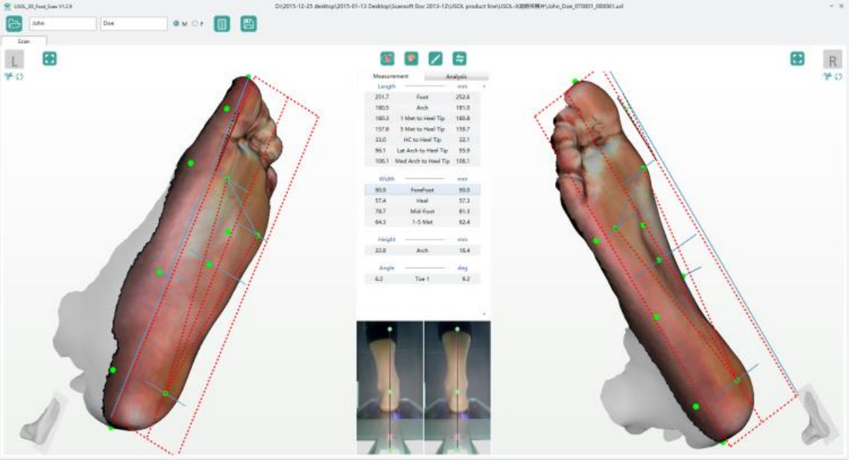 Ортопедический 3D-сканер ScanPod3D USOL-X