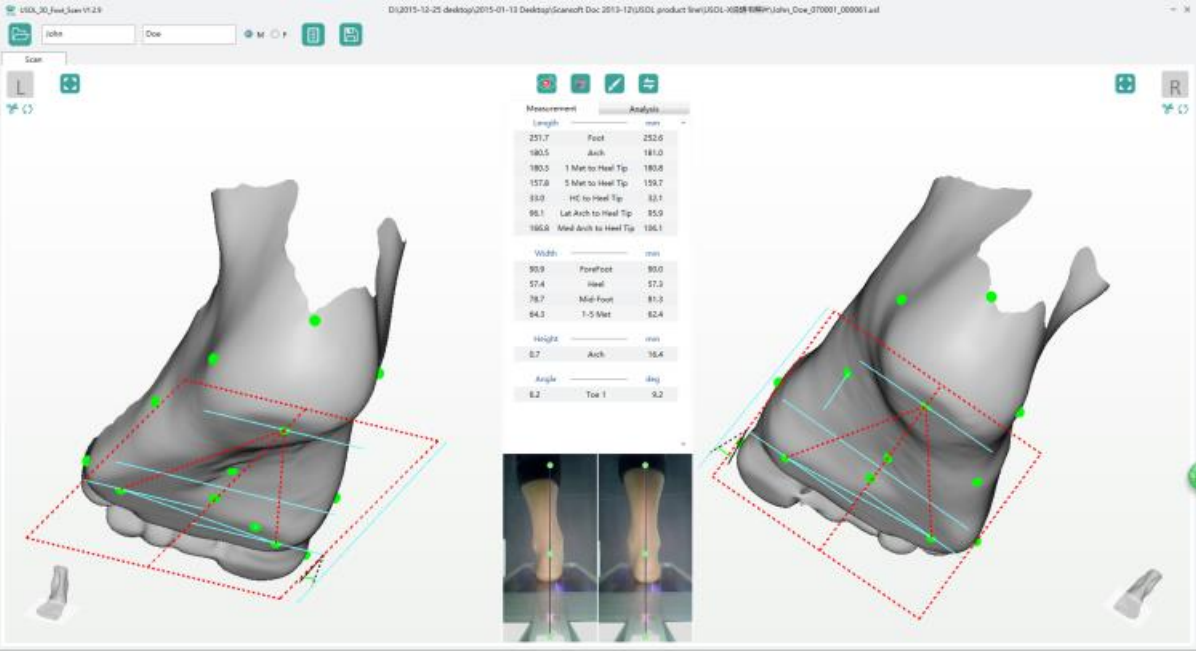 Ортопедический 3D-сканер ScanPod3D USOL-X