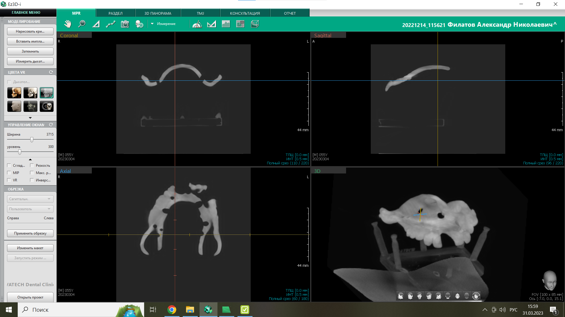 "Dental X-Ray" LCD/DLP 1 кг фотополимерная смола "Gorky Liquid "