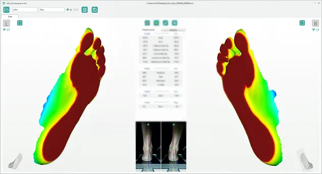 Ортопедический сканер ScanPod3D USOL-DUO