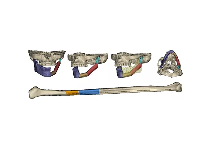 Программный продукт Materialise Mimics Innovation Suite (MIS)