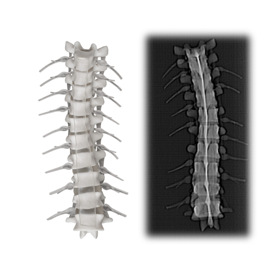 Stratasys RadioMatrix