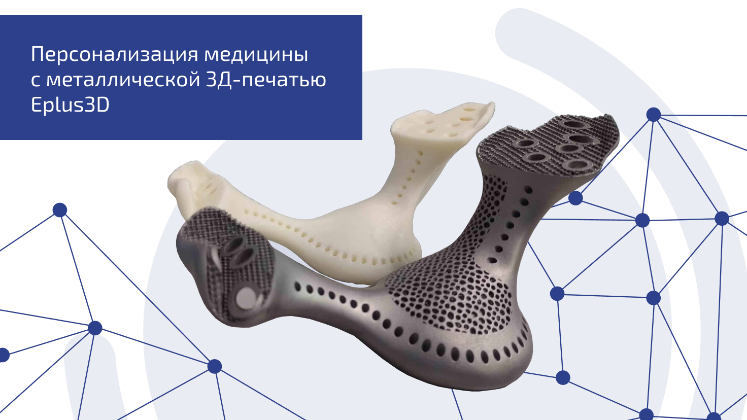 Персонализация медицины с металлической 3Д печатью Eplus3D