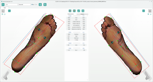 Фото Ортопедический 3D сканер ScanPod3D USOL 1