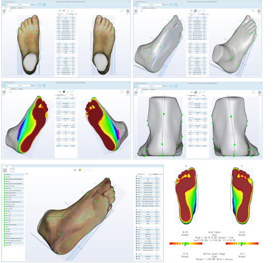 Ортопедический 3D-сканер ScanPod3D XPOD-SS