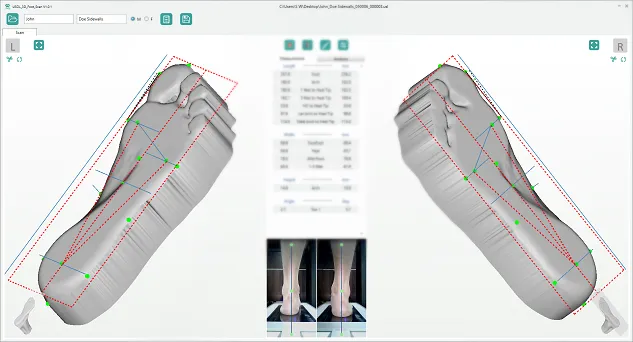 Ортопедический 3D-сканер USOL-DUO